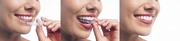 Get Invisalign Treatment in Calgary NW