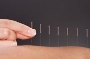 Chinese Acupuncture Treatment Clinic