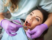 Dental Cleaning Services NE Calgary